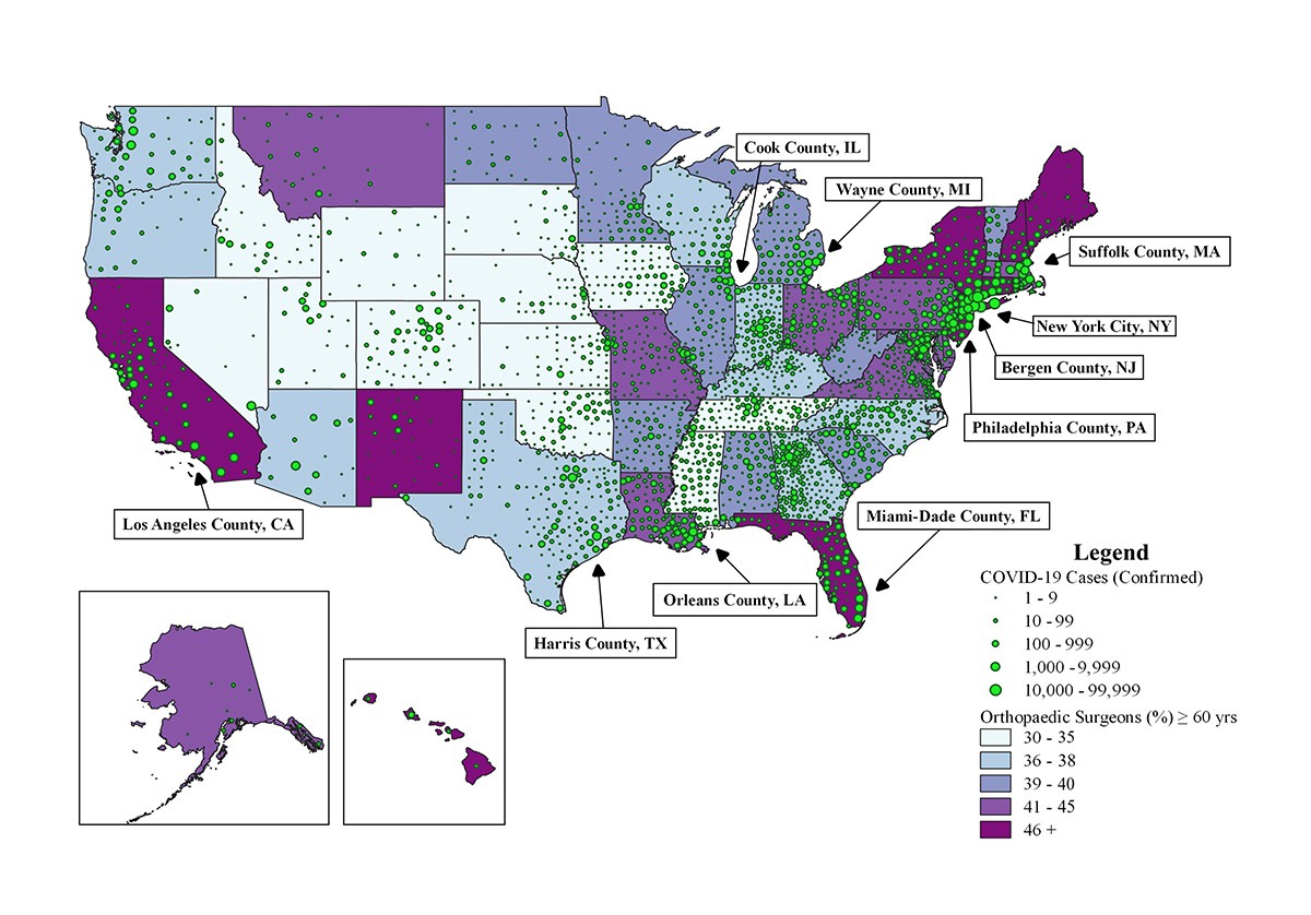This geospatial map from Tarun Jella's research looks at the distribution of U.S. orthopaedic surgeons aged 60 years and older.